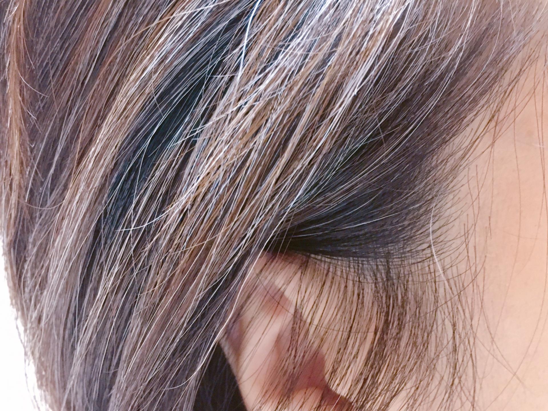 若白髪・白髪が増える本当の理由——銅・亜鉛・ビタミンB12・カタラーゼの分子栄養学